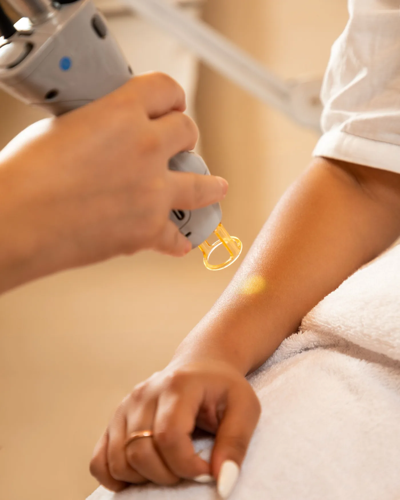 Aplicação de laser para clareamento de tatuagem de pequeno porte, com proteção ocular e equipamento de precisão