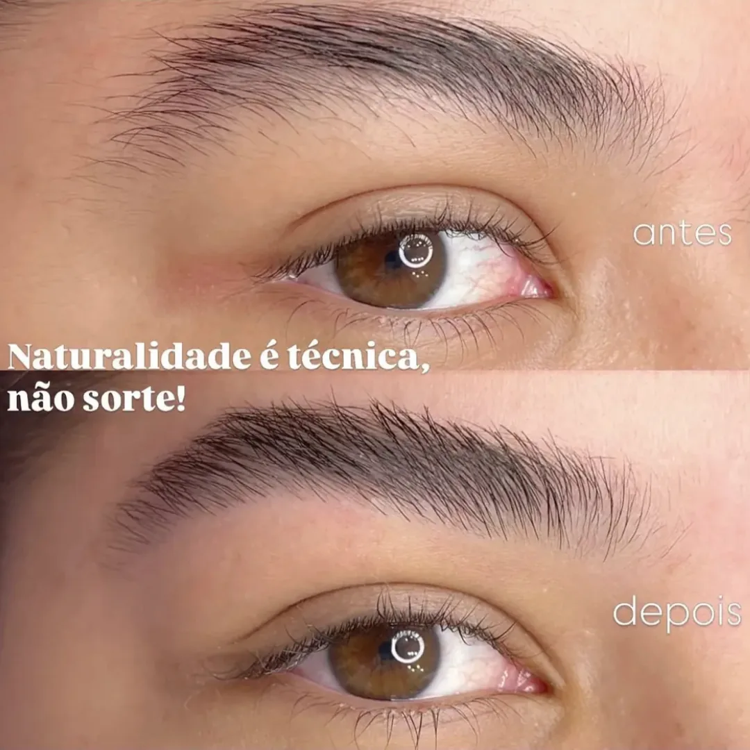 Sobrancelha antes e depois de design estratégico, em vista aproximada dos olhos