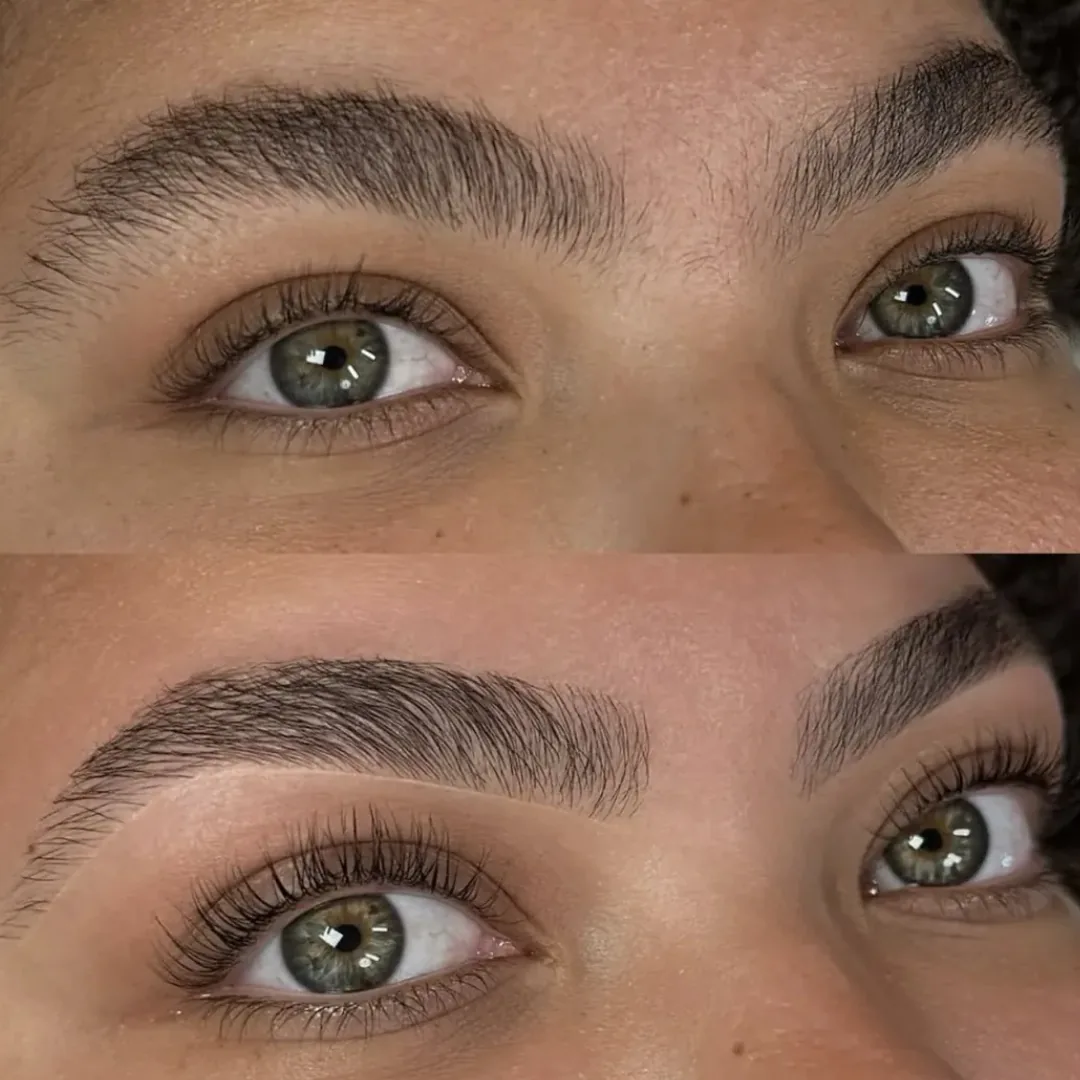 Par de sobrancelhas antes e depois de design estratégico, em vista frontal dos olhos