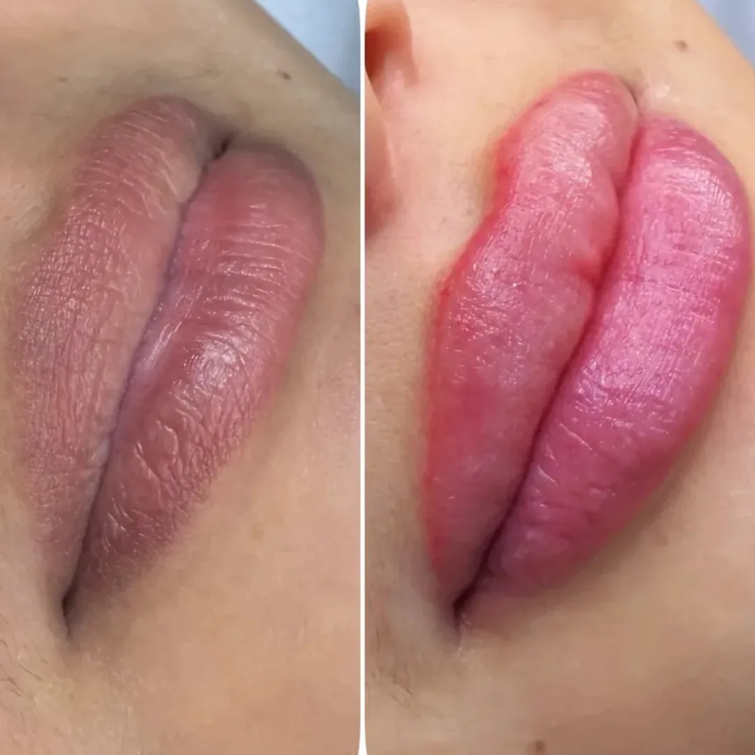 Lábios antes e depois de micropigmentação labial, em vista aproximada
